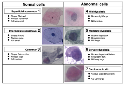 Sample images with their Nucleus and cytoplasmic feature from Herlev Dataset