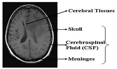 Brain image details