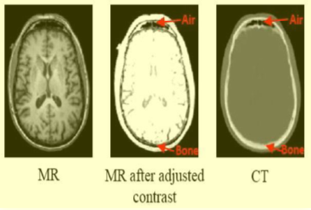 CT Extraction from MRI Images