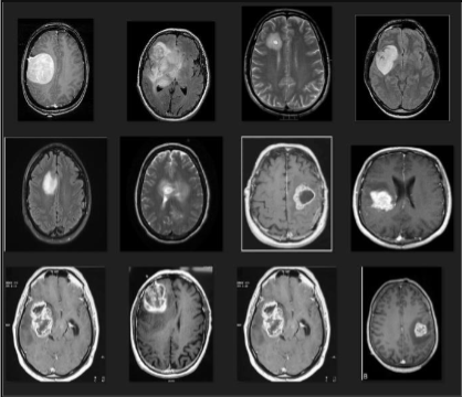 Images with Tumors